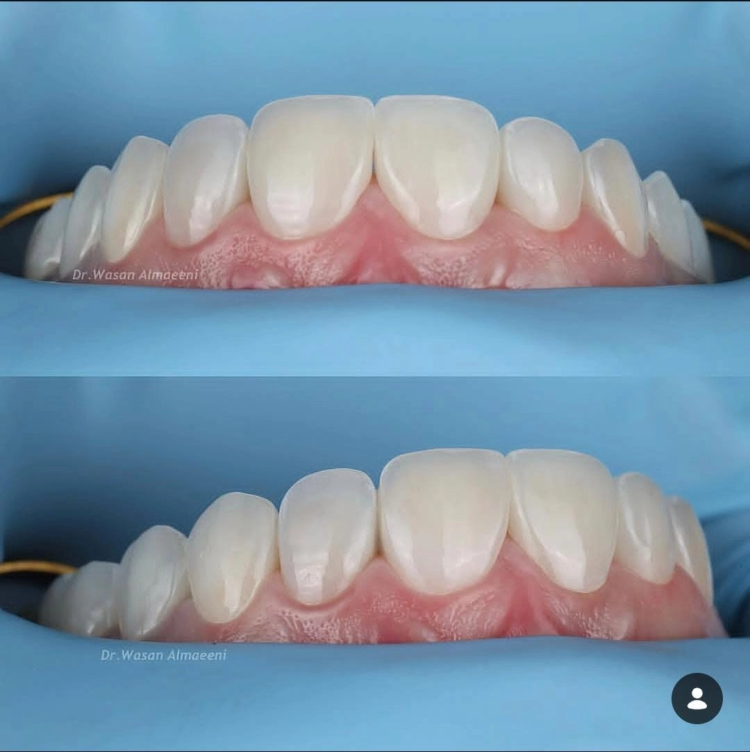 أسنان وردية صحية — @_dental_home_clinic_